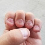 כסיסת צפרנים